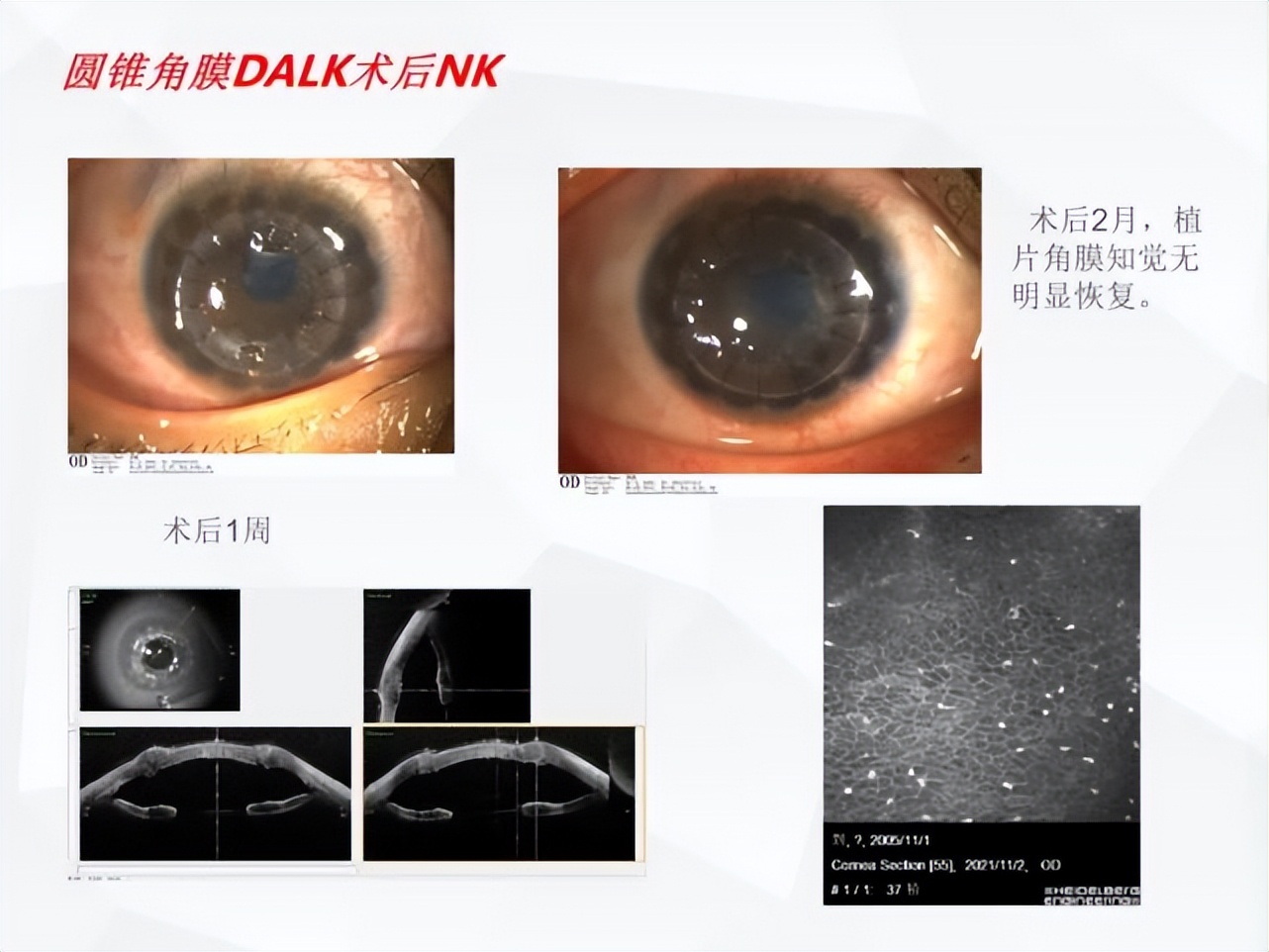 邓志宏几号坐诊,湘雅附三眼科邓志宏简历