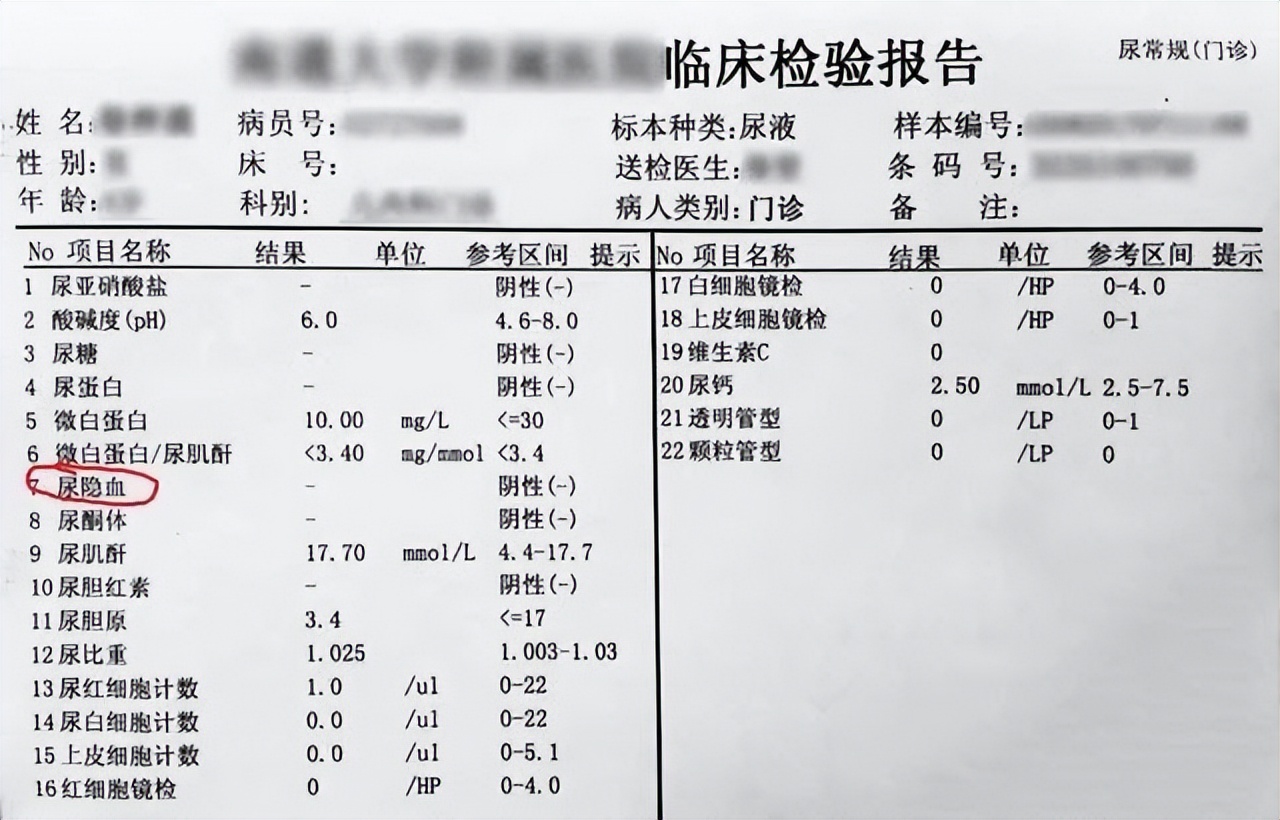 尿潜血试验阳性尿白细胞阳性,尿潜血试验阳性吃什么药治疗