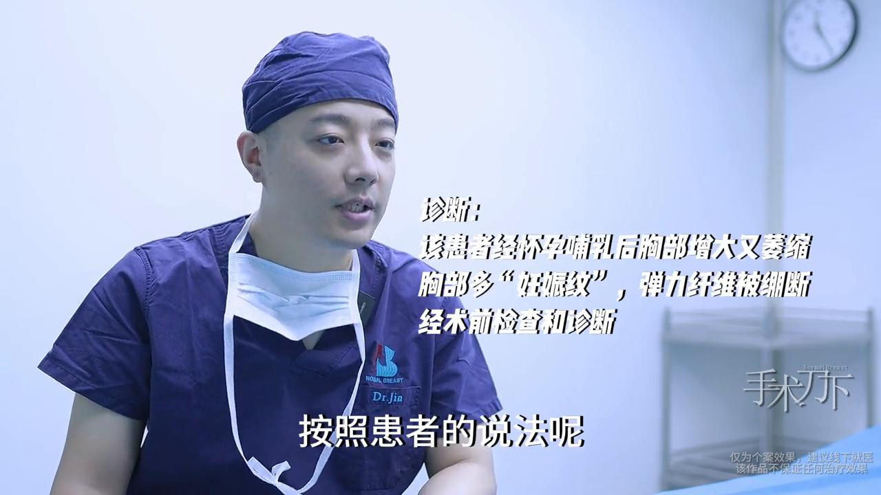 胸部多大需要做缩胸手术,乳房下垂严重缩胸矫正