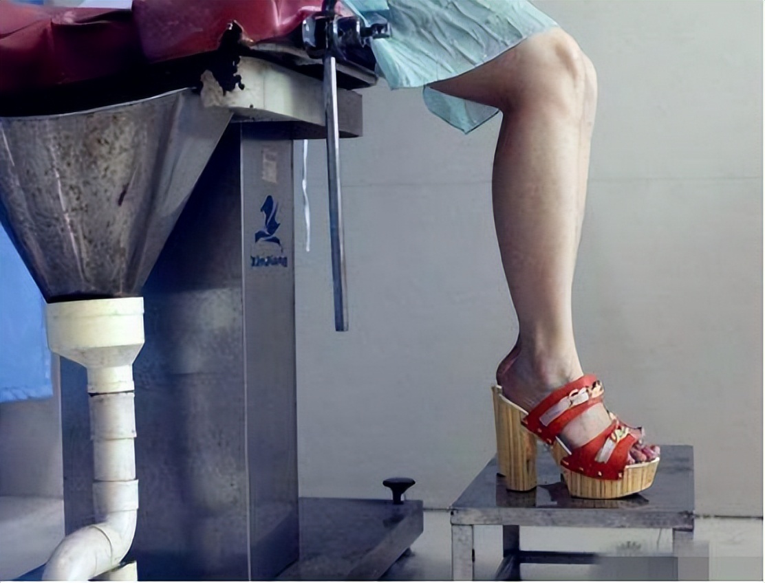 女人切除子宫后身体会有4种变化,子宫摘除手术有几种