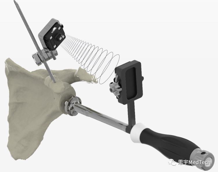 年入25亿,瑞士骨科公司发展之路