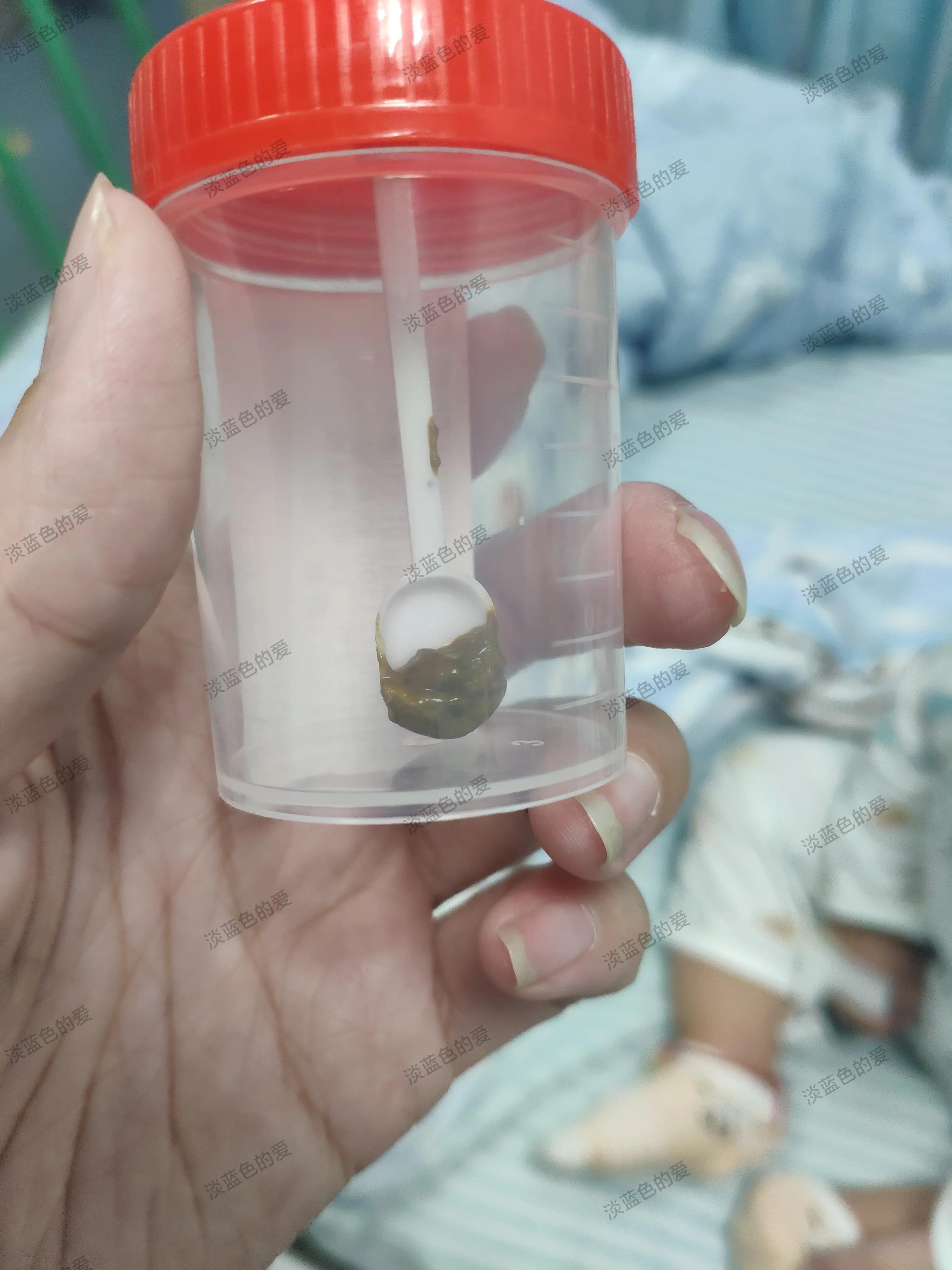 老是高烧不退畏寒什么原因,高烧5天反复不退什么原因