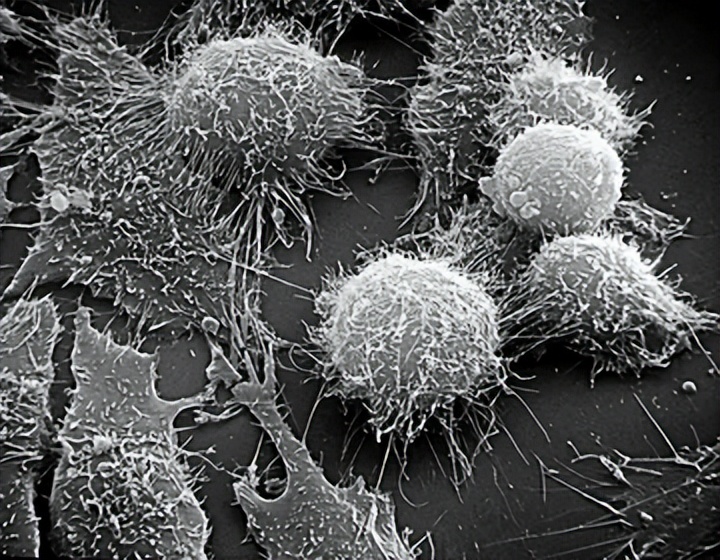 发酵液的提取常用方法,发酵液提取分离的主要方法