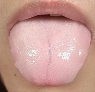 出汗多了该怎么调理,身体这4处常出汗要警惕