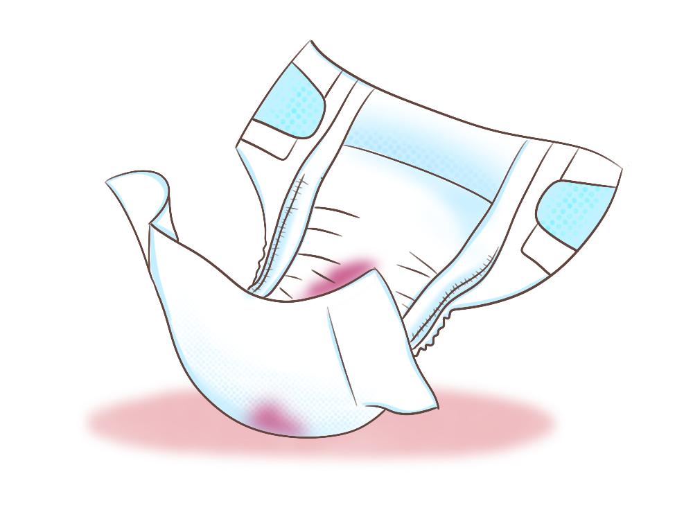 小婴儿也会来大姨妈吗,宝宝10个月了第一次来大姨妈