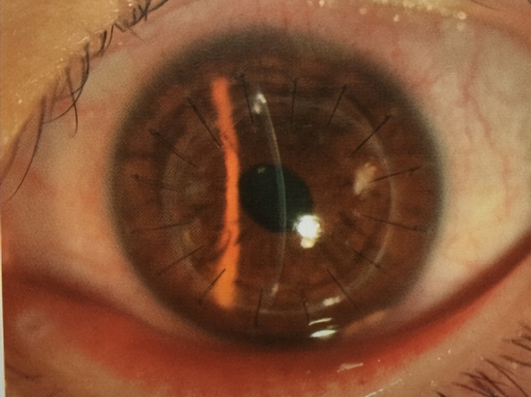 邓志宏几号坐诊,湘雅附三眼科邓志宏简历