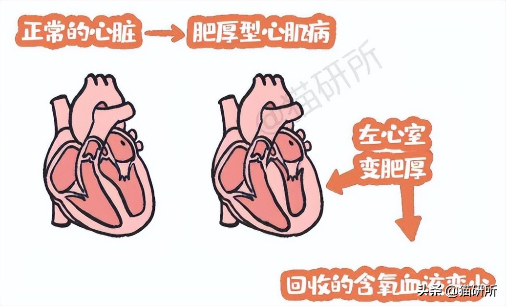 猫肥厚型心肌病分几期,猫得了hcm肥厚型心肌病