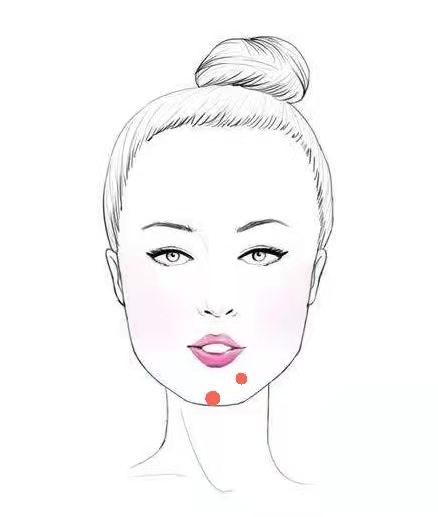 女人脸上有痘痘是什么原因造成的,脸上出痘痘的位置图解