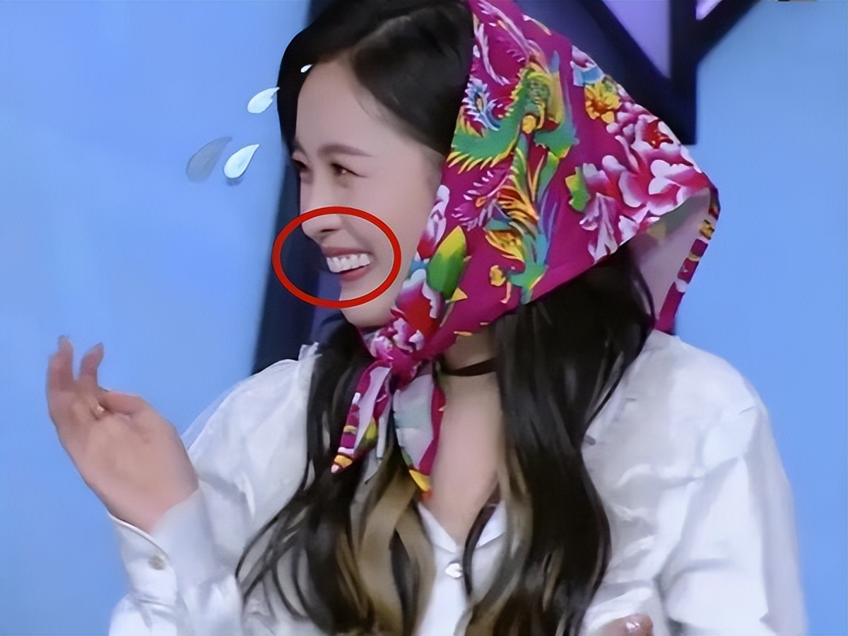 明星做烤瓷牙把真牙去掉吗,明星的烤瓷牙是怎么弄的