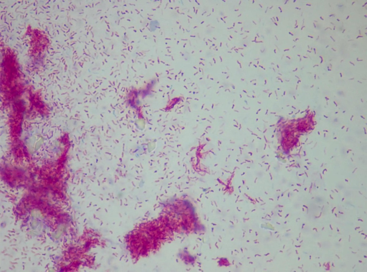 革兰氏阳性孢子,革兰氏阳性孢子菌