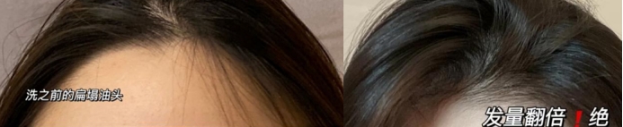 适合孕期使用的洗发水推荐,孕期适合使用的洗发水有啥牌子