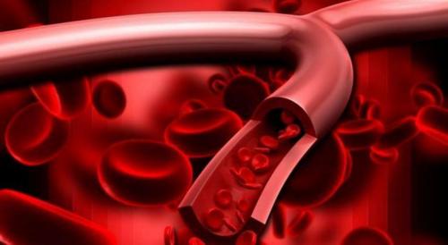 桥本甲状腺炎中医解释,中医对桥本氏甲状腺炎的认识