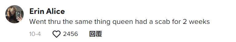 澳洲妹子和男友接吻,澳大利亚女子与男友接吻