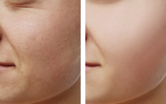 皮肤过敏不舒服怎么办,手和脚皮肤过敏一招解决方法