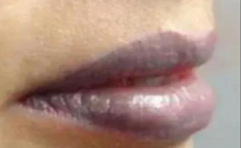 纹唇后期唇部发黑补色可以遮住吗,纹唇颜色发乌后期怎么补色