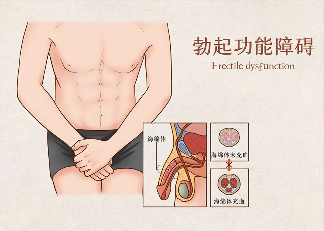 怎么治疗紧张的心理障碍,性心理紧张怎么调理