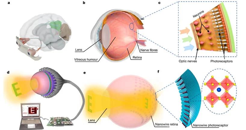 3d仿生眼镜真的有用吗,3d仿生眼球能让青光眼重见光明吗