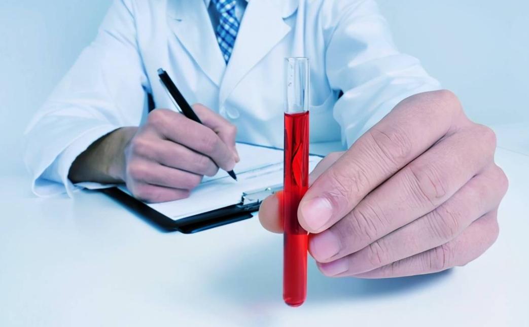 这些食物升糖快最好管住嘴,100种常见食物升糖指数快收藏