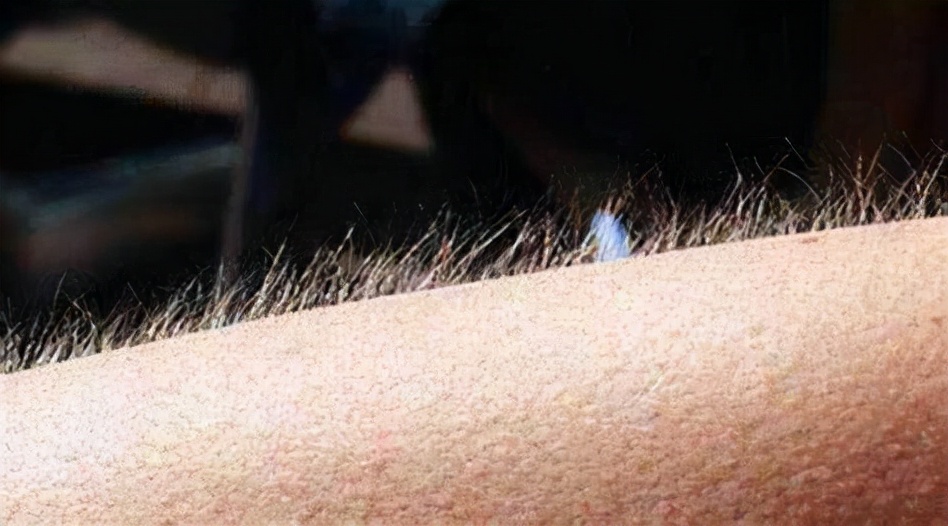 人类进化毛发少的好处,人类毛发进化为什么保留鬓角