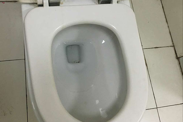 怎么有助于大便的正常排出,大便时看什么利于排便