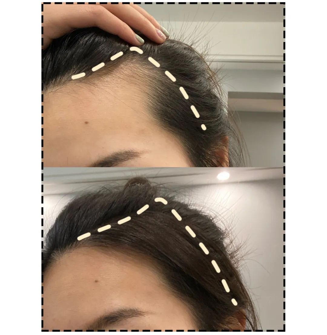 发量少发际线高发型解决方案,30-40岁男士发型稳重发际线高