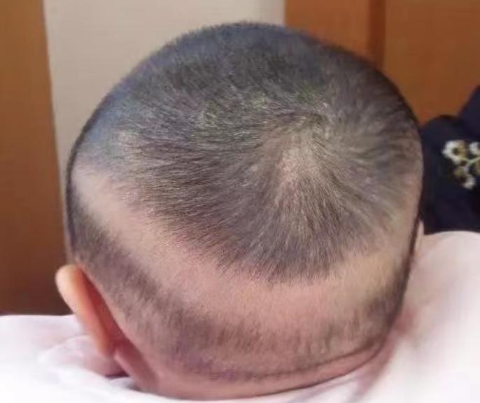 10个月婴儿白天摇头摇几下,宝宝七个月有时候摇头为什么