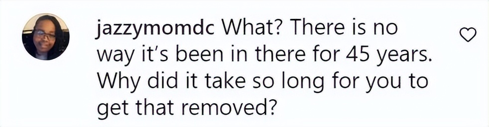 美国女子被橡皮子弹击中,女子手术取出戳20年铅笔芯