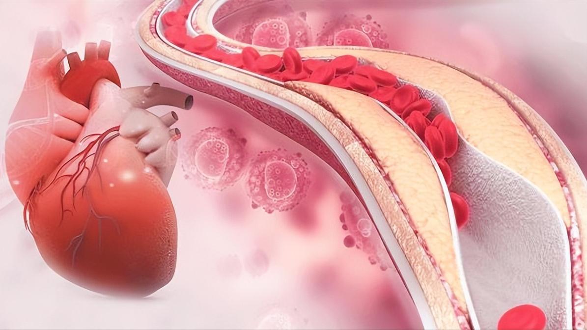 这是一封医生写给颈椎病患者的长信！如果您深受其扰，请看此文