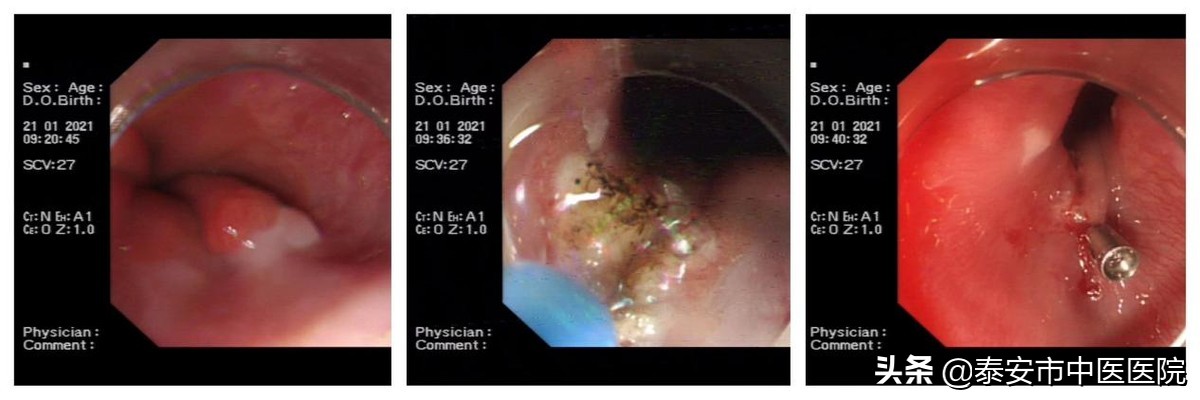 消化内镜微创诊治,消化内镜及消化疾病诊治