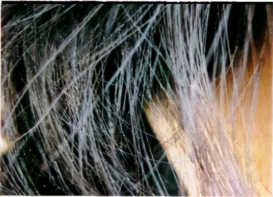 掉的头发根部没有小白点,头发根部小白点掉了还会长吗