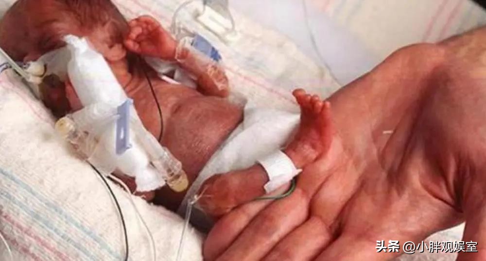 真的拇指姑娘现在怎么样了,现实版拇指姑娘如今怎样了