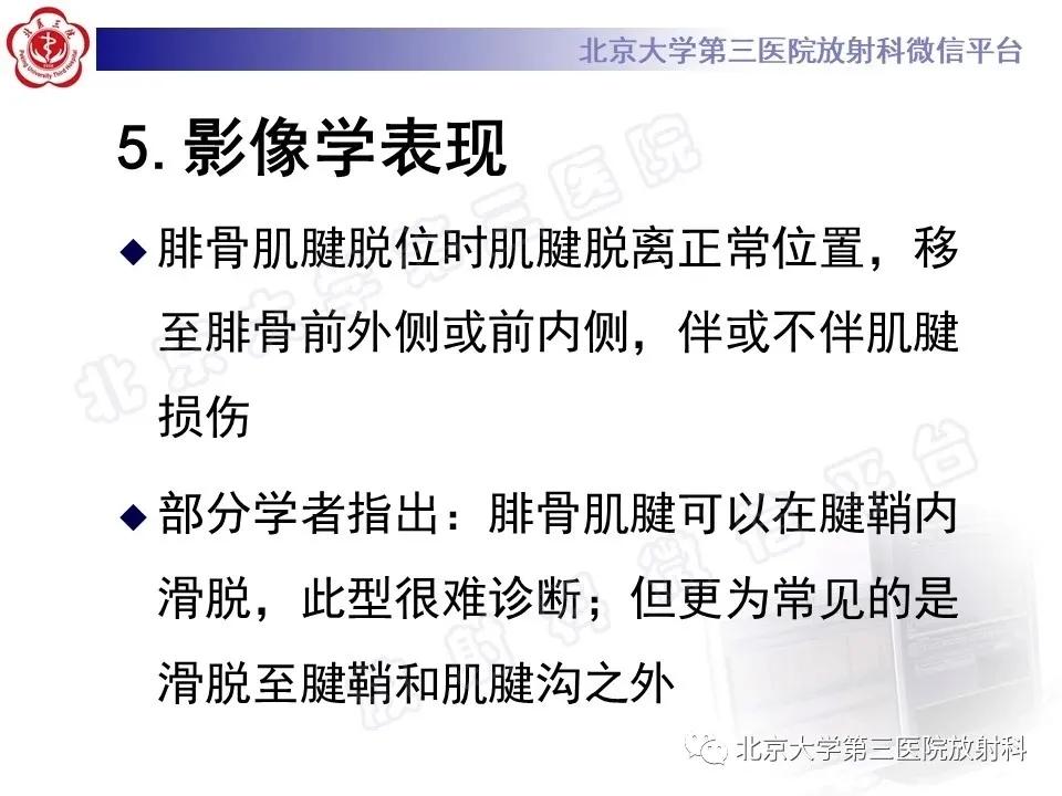 好文分享续集,腓骨肌腱脱位手术价格