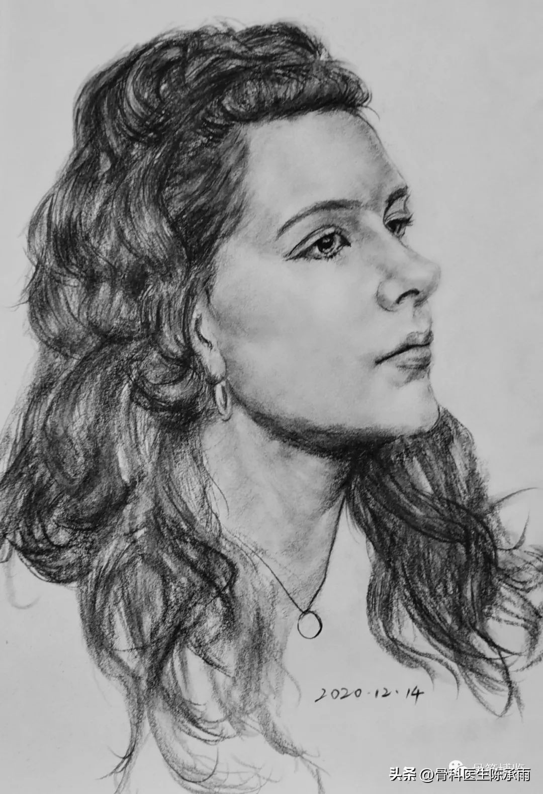 化脓性关节炎的穿刺引流治疗,关节炎镜下治疗