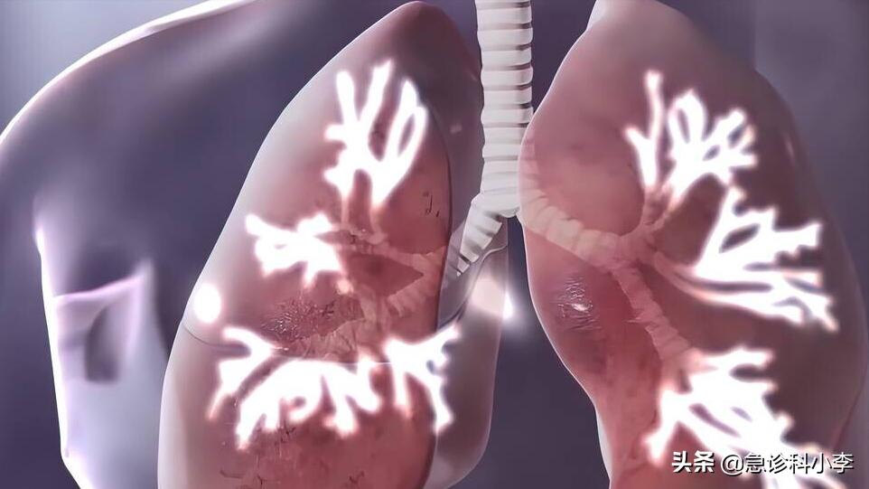 晚上睡觉嘴巴总发干是真的缺水吗,为什么夜晚睡觉嘴巴干