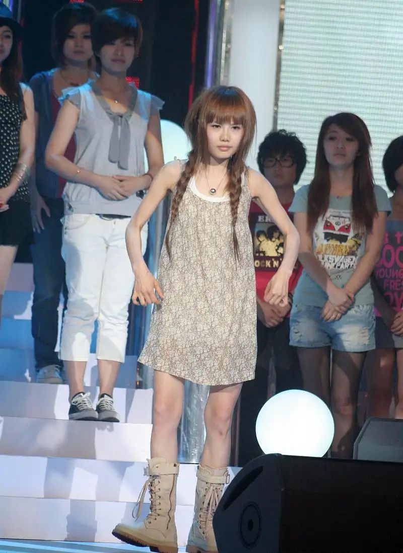 女歌手整容失败索赔100万,女歌手整容失败索赔2019