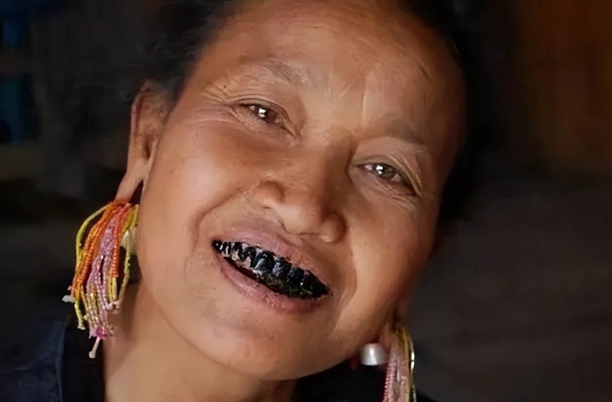 槟榔的危害有多严重,槟榔对身体的危害真的有那么大吗