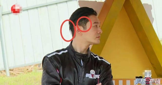 明星逃不过的脱发,明星也秃头还戴假发片