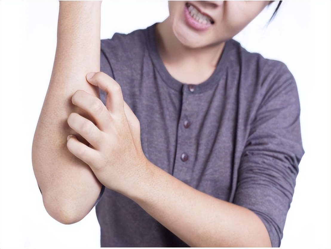 神经性皮炎喝过中药后为啥更痒,手越抓越痒是皮炎还是真菌感染