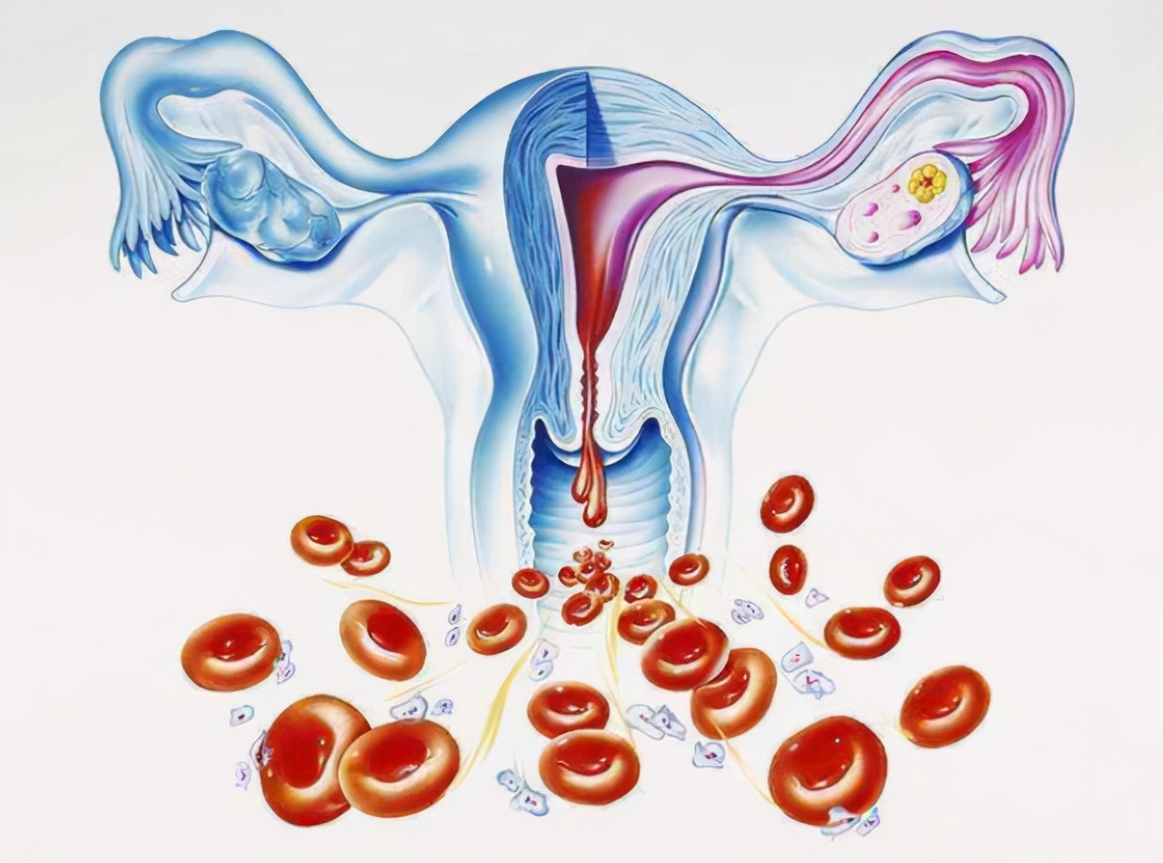 中医治疗多囊卵巢综合症效果好吗,舒氏针灸一般能治好多囊卵巢吗