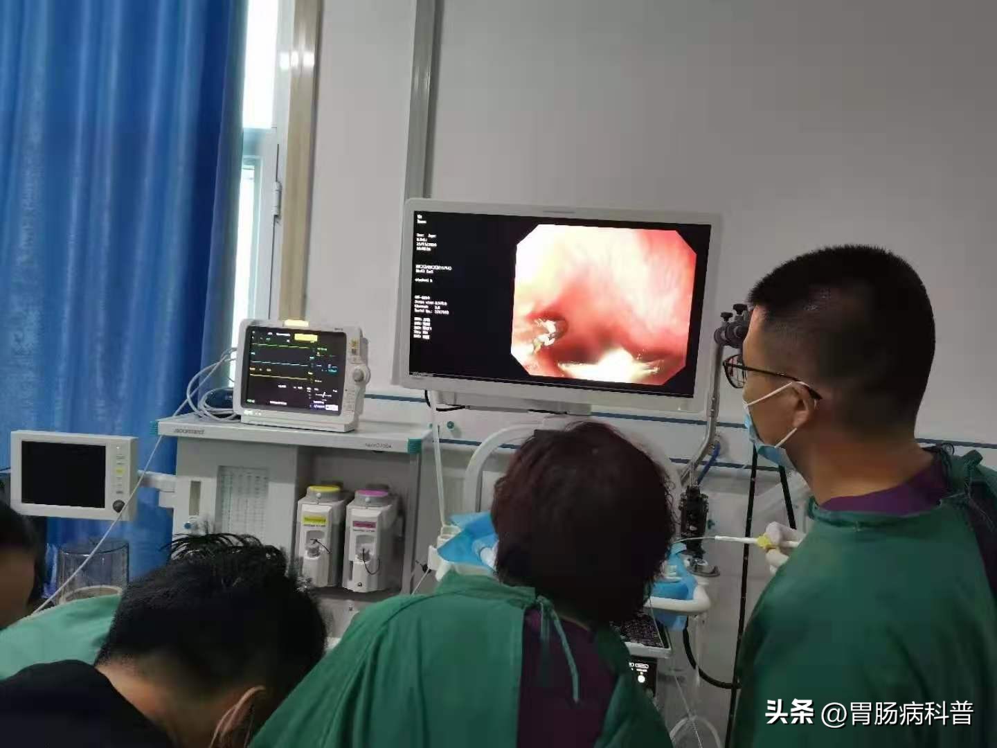 胃癌筛查除了胃镜还有什么方式,担心胃癌又不想做胃镜三步筛查