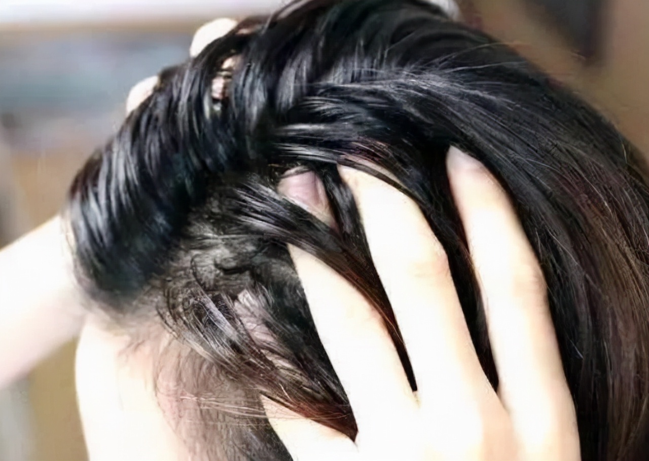 女子坚持用硫磺皂水洗头,一女子坚持硫磺皂洗脸半年变化图