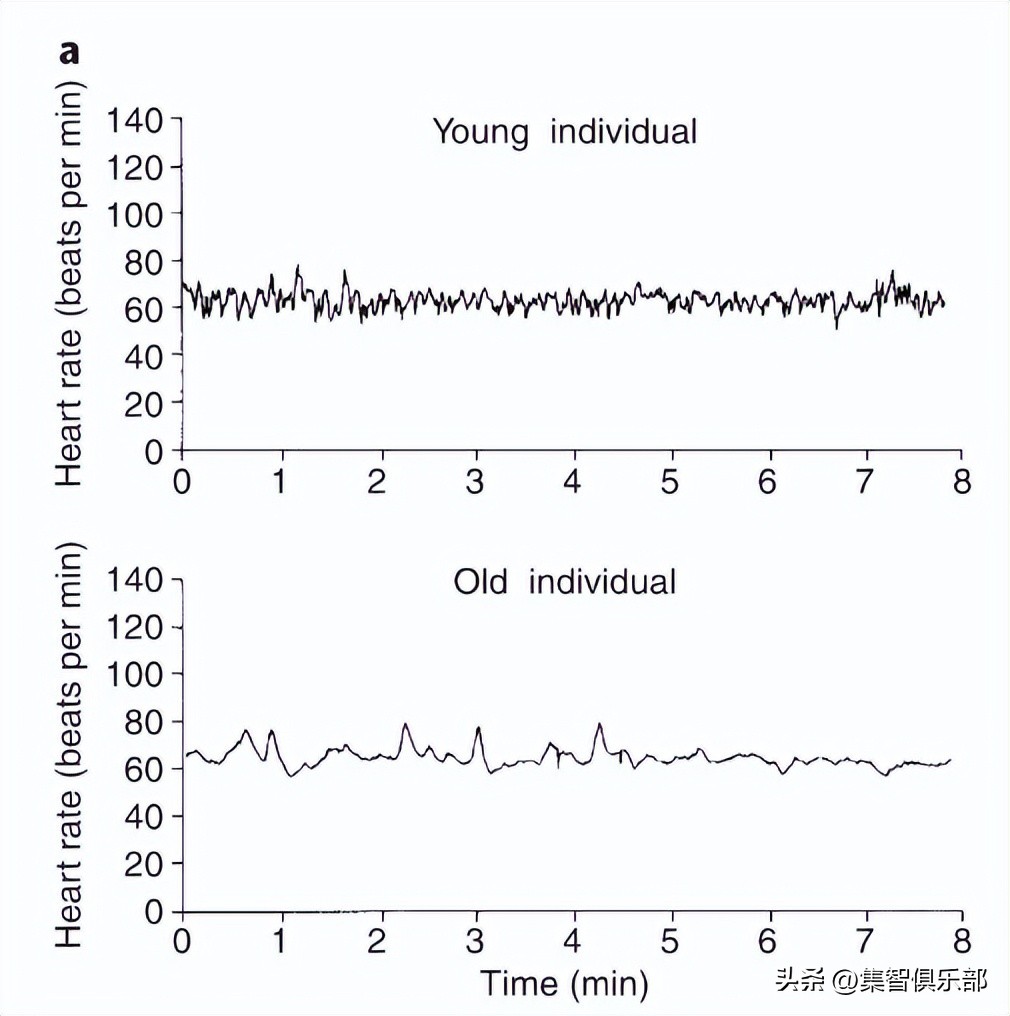 衰老分为生理性衰老和病理性衰老,衰老的特点与相关理论