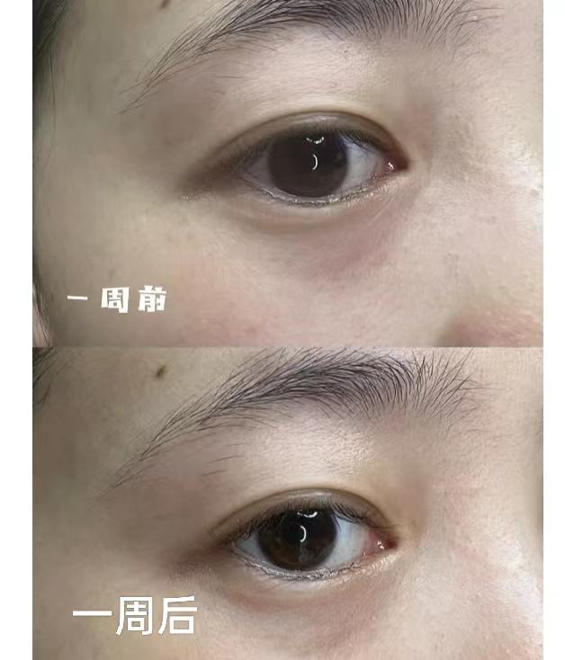 去眼袋眼霜效果排名国货眼霜,眼霜该买贵的还是便宜的