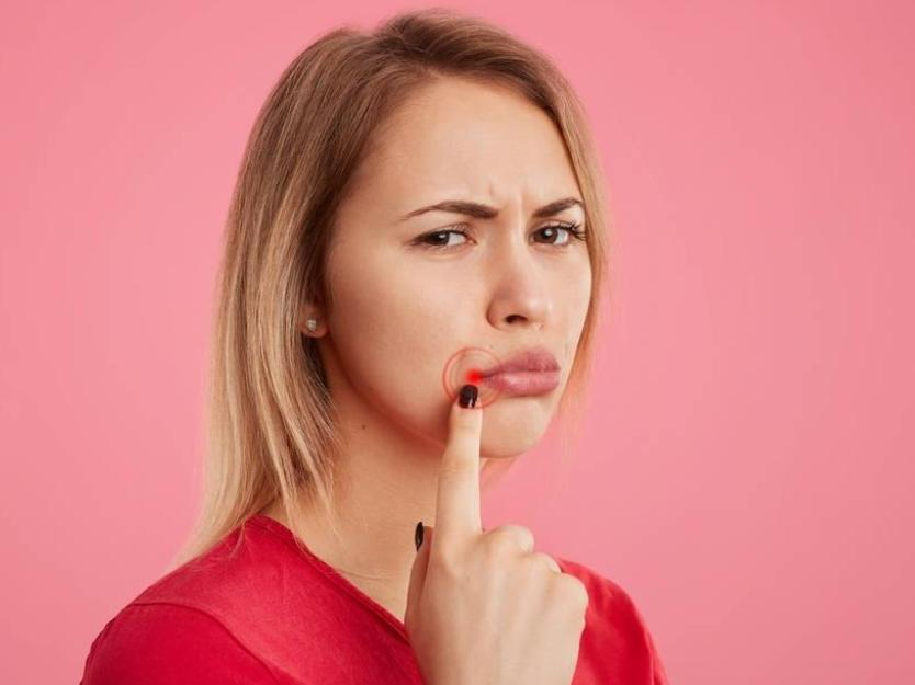 反复口腔溃疡跟克罗恩病有关系吗,被误以为口腔溃疡的癌症