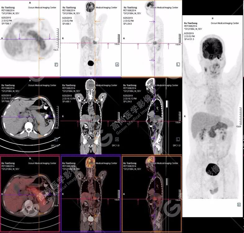 皮肤巩膜黄染无腹痛,腹部皮肤出现黄染