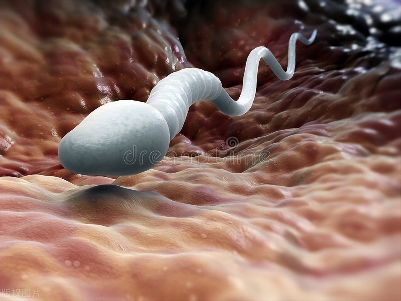 精液变黄是什么原因？是感染性病了吗？医生提醒：要注意这4大点