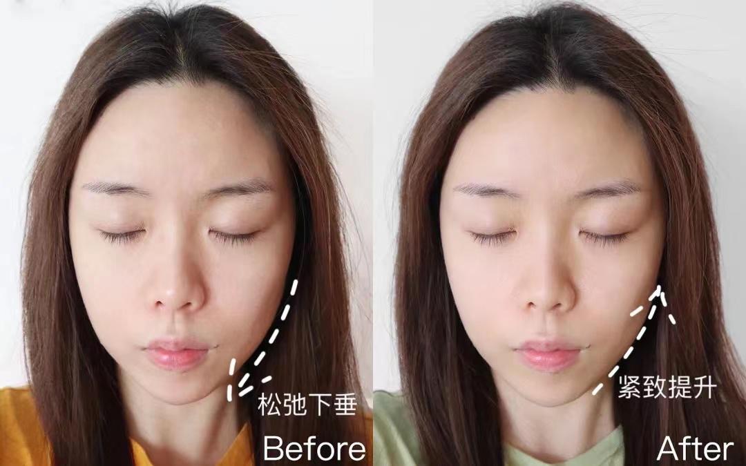 欧莱雅玻色因pro真假,国产玻色因可以代替欧莱雅吗