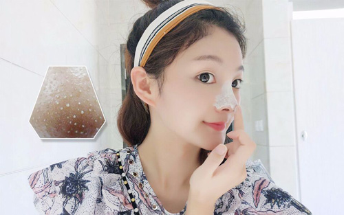 护肤去黑头顺序的正确步骤,护肤小妙招祛黑头白头