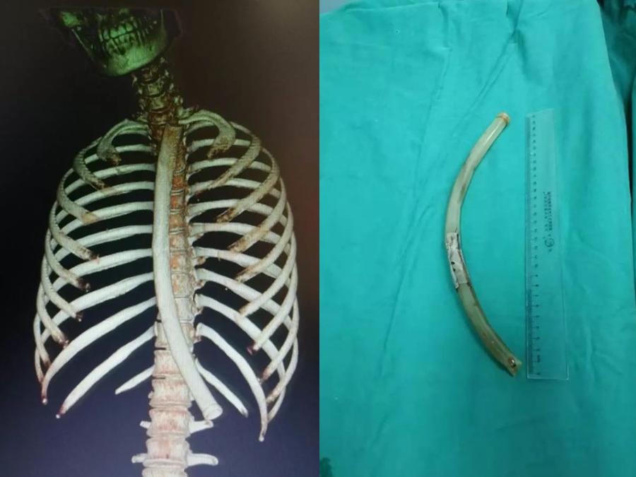 这种人见人爱的身材，获得方式真的很变态