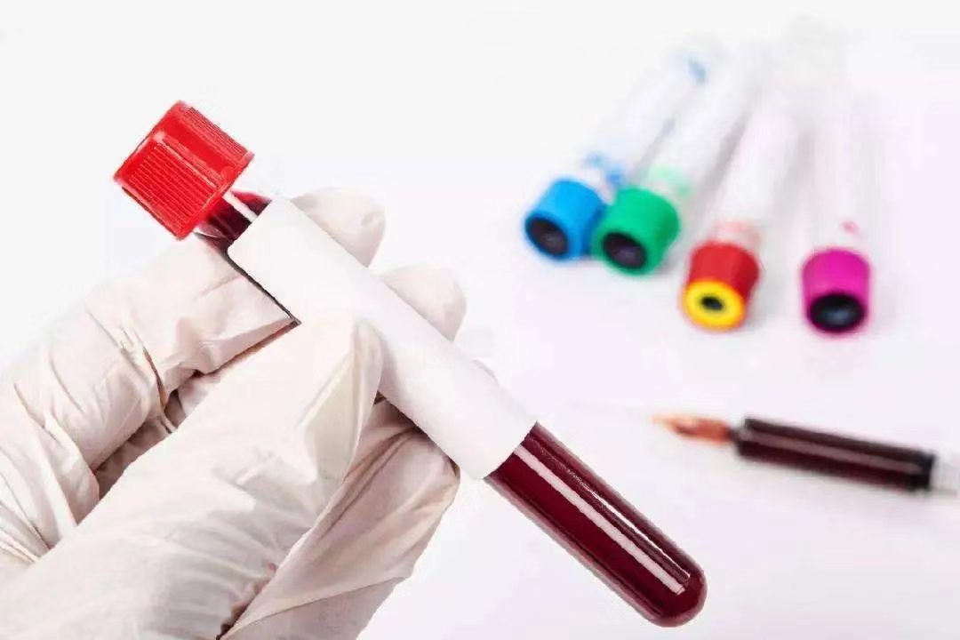 贫血吃红枣可以改善吗,贫血吃红枣真的有效吗